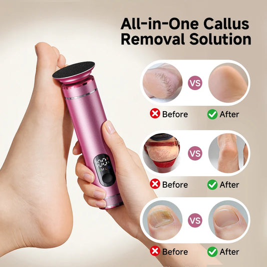 Aluminum Alloy 2 in 1 ElectricFoot Callus Remover with 60pcs Sandpaper Discs, Adjustable Foot File Nail Polisher With Gift Box