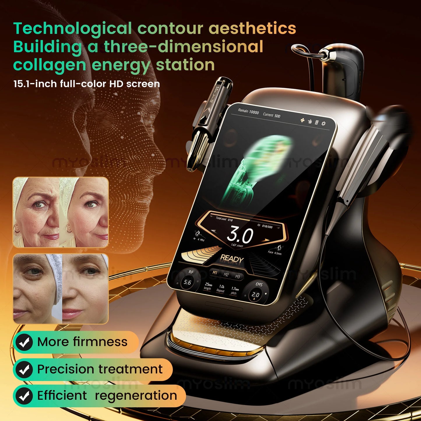360MAX 25D HiFU 3 In 1 Technology Machine For Non Invasive Facial Slimming Anti Aging And Body Firming