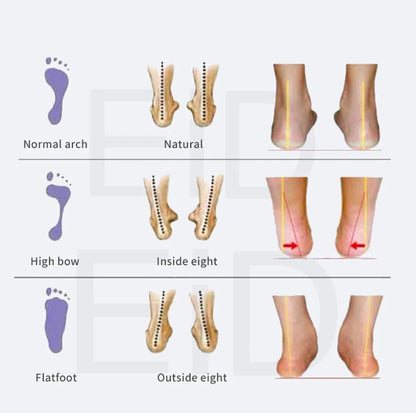 EiD Severe Flat feet insoles EVA Orthotic Arch Support Inserts Orthopedic Shoes Insoles Heel Pain Plantar Fasciitis Men Woman