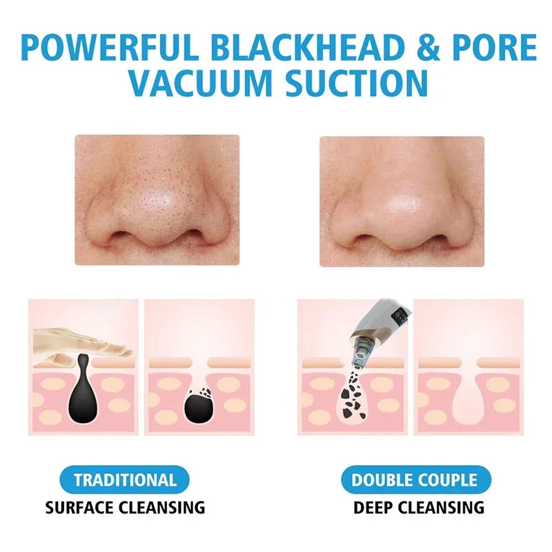 Electric Blackhead Remover Portable USB Facial Pore Cleaner Spot Acne Pimple Black Head 3 levels Clean Beauty Machine