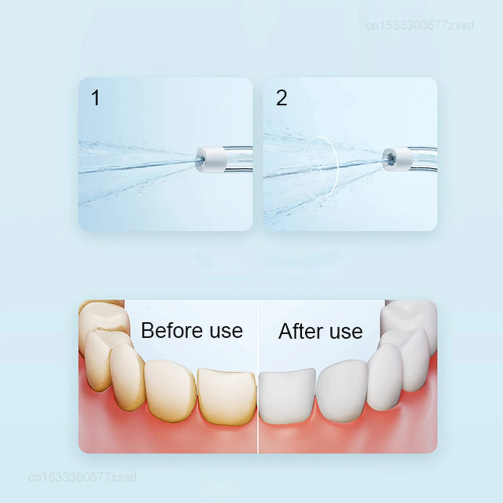 MIJIA F300 Portable Oral Irrigator Dental for Irrigator Teeth Water Flosser Bucal Calculi Oral Cleaner Water Thread Teeth