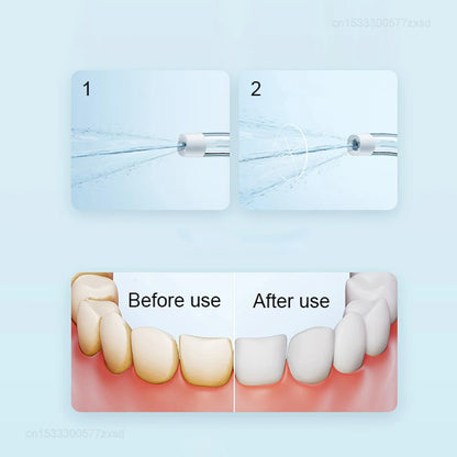 MIJIA F300 Portable Oral Irrigator Dental for Irrigator Teeth Water Flosser Bucal Calculi Oral Cleaner Water Thread Teeth