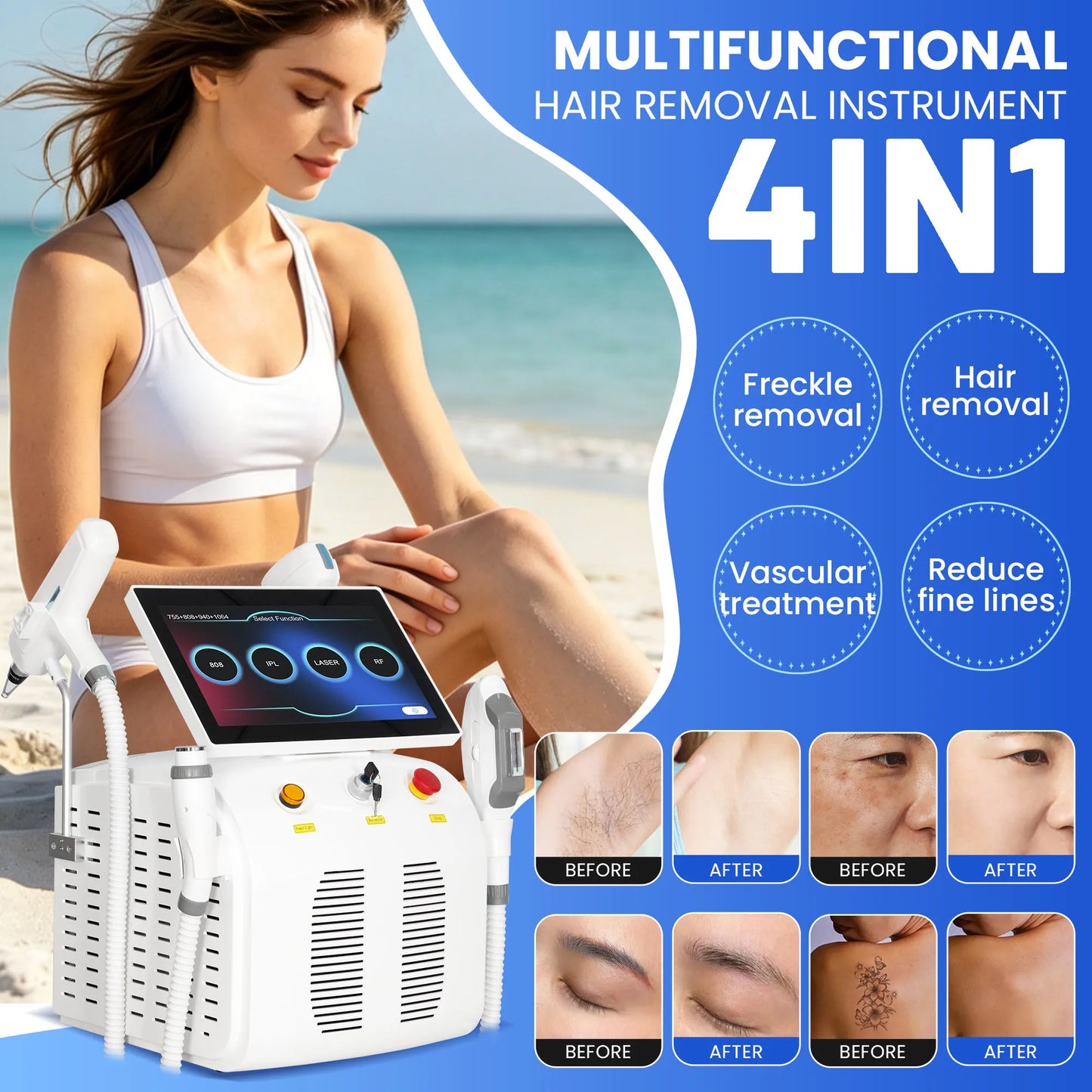 4 IN 1 Soprano Titanium Ice Platinum RF Diode 755 808 940 1064nm 4 Wave Laser ND:YAG Machine Painless Hair Removal Machine