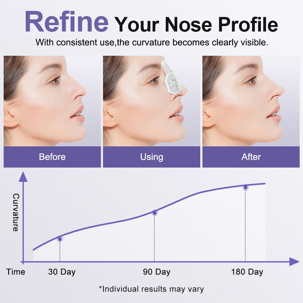 EMS Beauty Nose Shaper Clip Microcurrent Pulse Vibration High Bridge Nose Sculpting Massager Nose Up Lifter Massage Tool