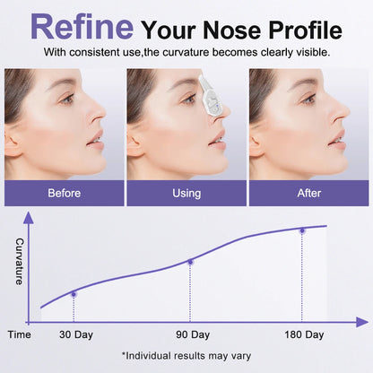 EMS Beauty Nose Shaper Clip Microcurrent Pulse Vibration High Bridge Nose Sculpting Massager Nose Up Lifter Massage Tool
