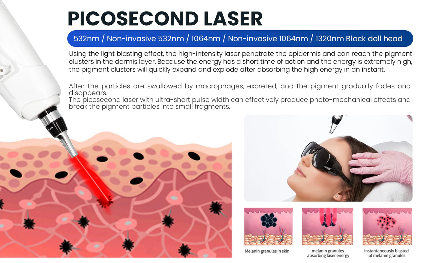 4 IN 1 Soprano Titanium Ice Platinum RF Diode 755 808 940 1064nm 4 Wave Laser ND:YAG Machine Painless Hair Removal Machine