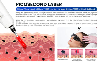 4 IN 1 Soprano Titanium Ice Platinum RF Diode 755 808 940 1064nm 4 Wave Laser ND:YAG Machine Painless Hair Removal Machine