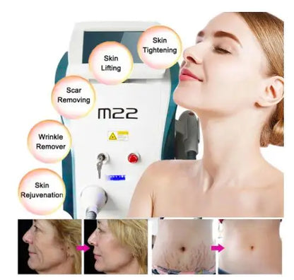 M22 2-in-1 M22 NG YAG laser tattoo removal and OPT IPL laser hair removal machine