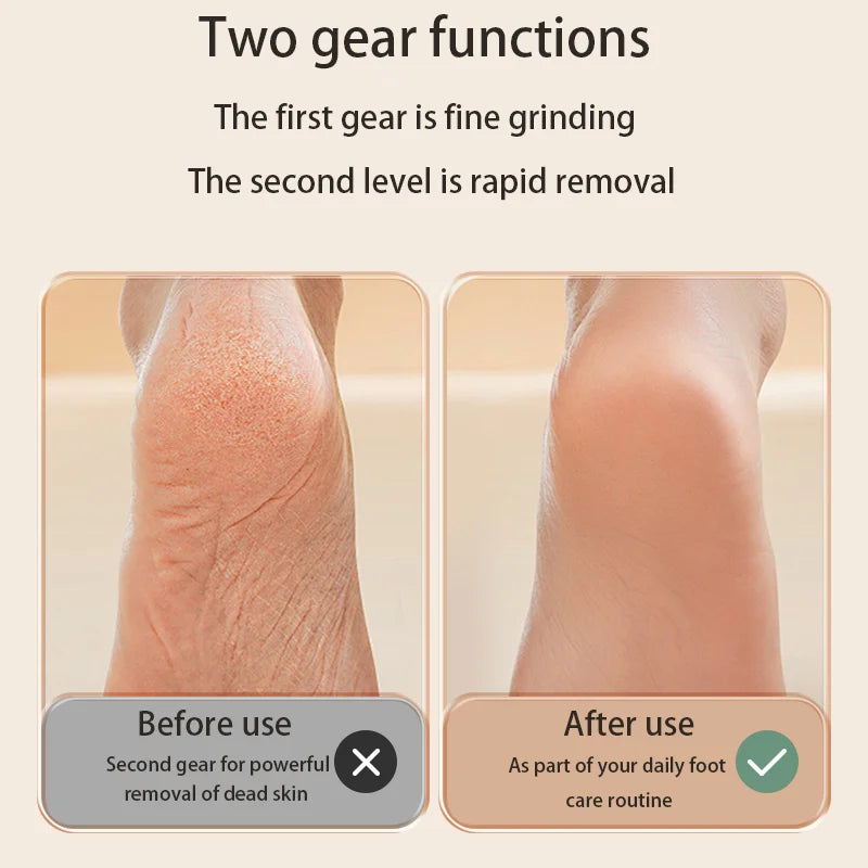 USB portable electric foot grinder, adjustable speed electric exfoliator, designed for professional care of dry, chapped skin