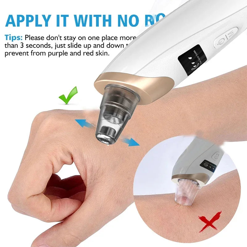 Electric Blackhead Remover Portable USB Facial Pore Cleaner Spot Acne Pimple Black Head 3 levels Clean Beauty Machine