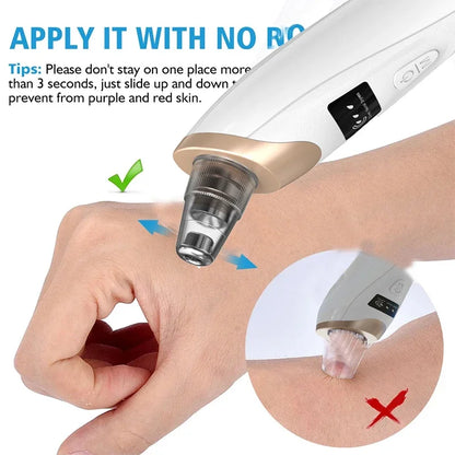 Electric Blackhead Remover Portable USB Facial Pore Cleaner Spot Acne Pimple Black Head 3 levels Clean Beauty Machine