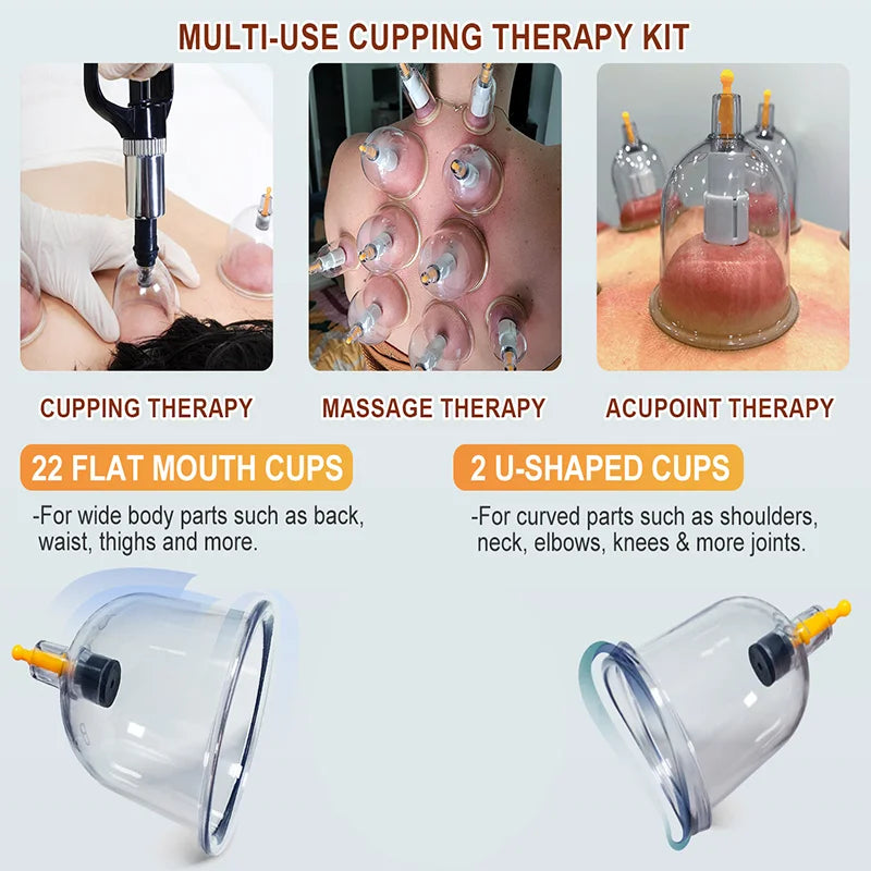 12-Piece Vacuum Cupping Set for Home Use, Flameless Suction Cups, Traditional Chinese Medicine Health Care, Gua Sha, Dampness Removal, Complete Set with Storage Bag