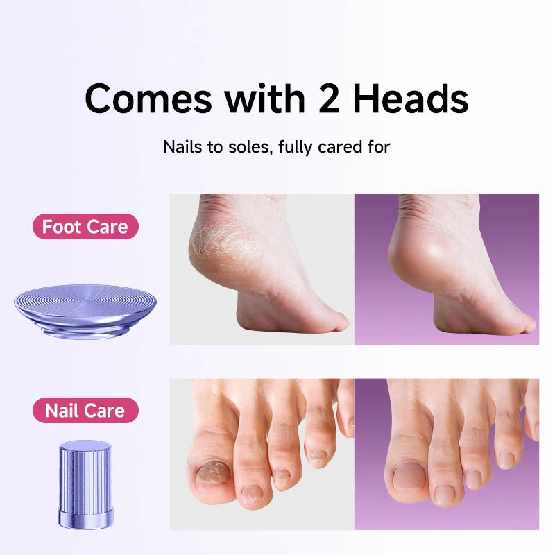 2-in-1 Electric Foot Grinder & Nail Grinder with 60 Sanding Discs Anti-Slip Striped Grip Aluminum Alloy Electric Callus Remover
