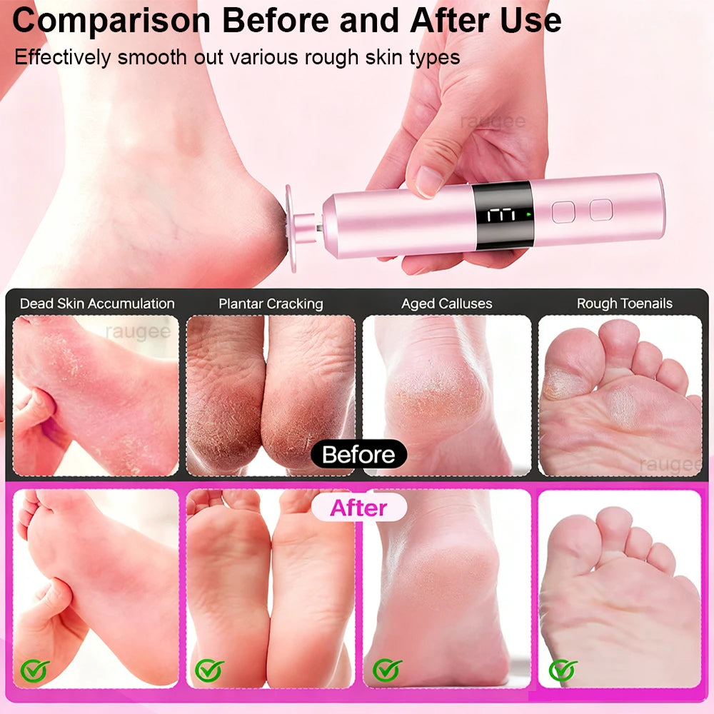 Electric Foot Grinder 2-in-1 Rechargeable Callus Remover Nail File Pedicure Machine for Dead Skin Foot Care