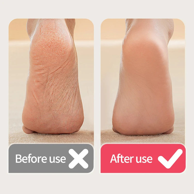 USB Powered Rechargeable Electric Foot Grinder Callus Remover with Adjustable Speeds for Men & Women's Pedicure