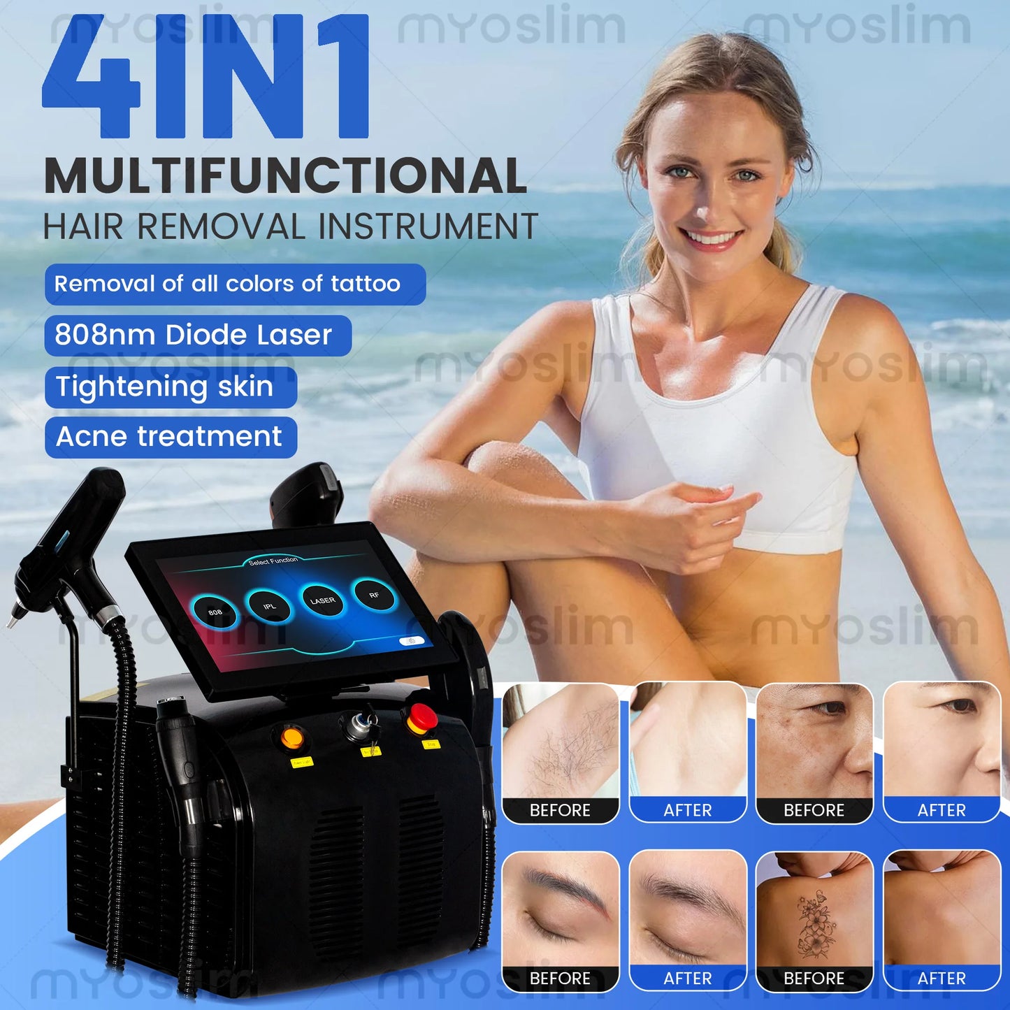 New 4-in-1 Titanium Ice 5000W RF Hair Removal 755/808/940/1064nm, Painless IPL Tattoo Removal Device CE