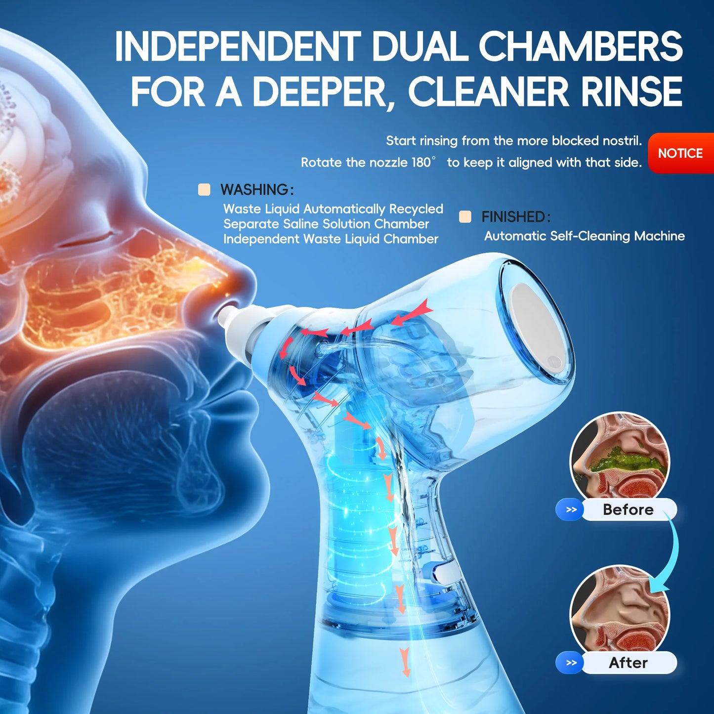 Electric Nasal Rinse Irrigation Self-Cleaning with Auto Waste Collection, 30 Salt Packets for Sinus Discomfort Relief
