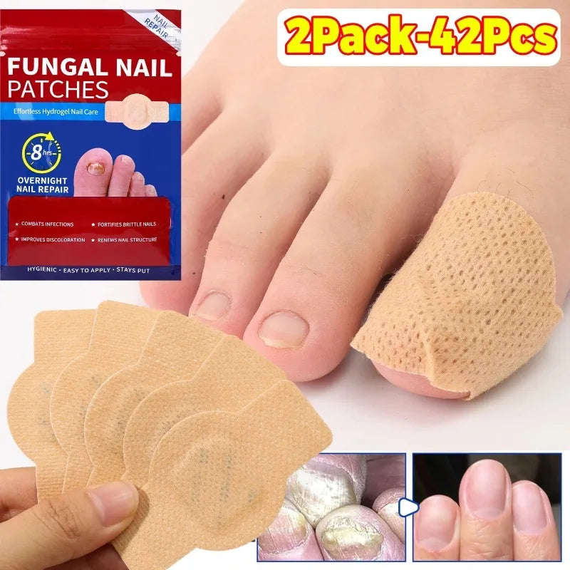 210pcs Waterproof Nail Fungus Correction Patch Finger Guard Bandage Nail Fungus Hollow Nail Cover Disguise Patch Toenail Care