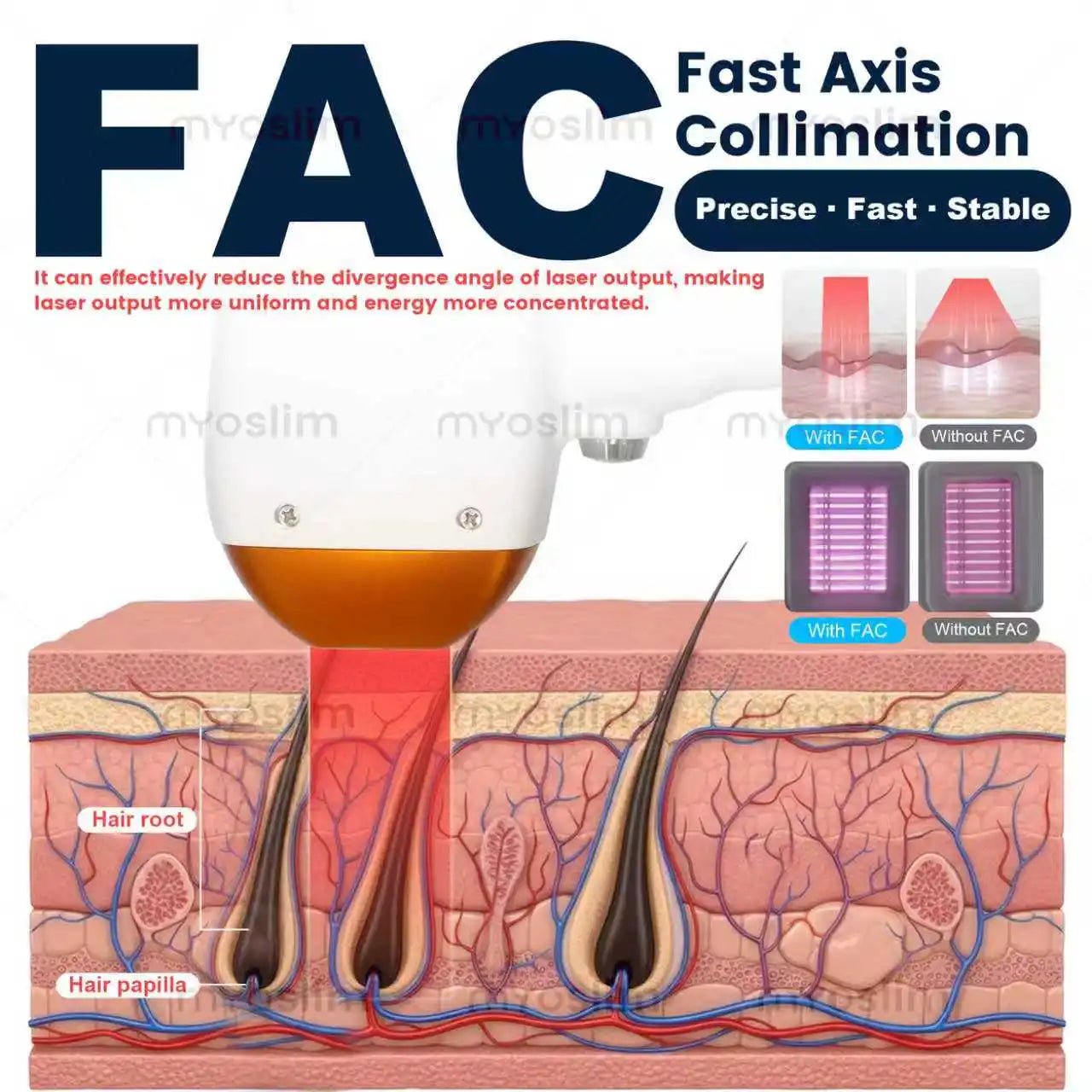 FAC 5000W Diode  Hair Removal   4-Wavelength Sapphire Ice Cooling & Ice Platinum System  Permanent Painless Hair Removal CE