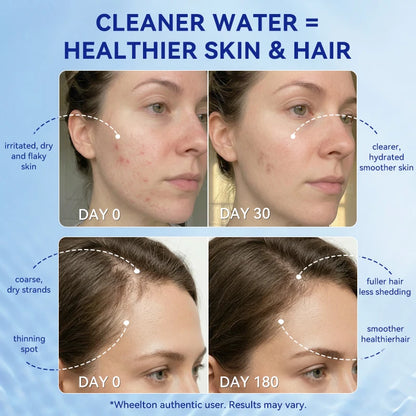 Wheelton Household Shower Water Filter - Filter Water Reduces Chlorine Heavy Metal  Sediment Improves Dry Itchy Skin & Hairloss