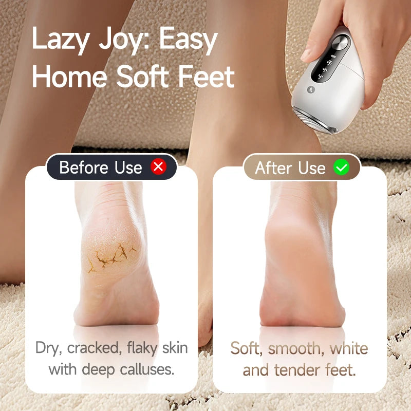 Electric Foot Grinder Foot Callus Remover Auto Thick Leather Polishing Foot Grinder with 2 Grinding Heads Foot Beauty Machine