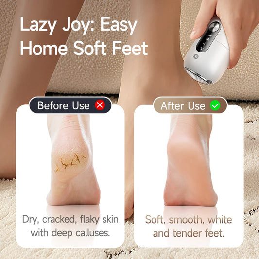 Electric Foot Grinder Foot Callus Remover Auto Thick Leather Polishing Foot Grinder with 2 Grinding Heads Foot Beauty Machine
