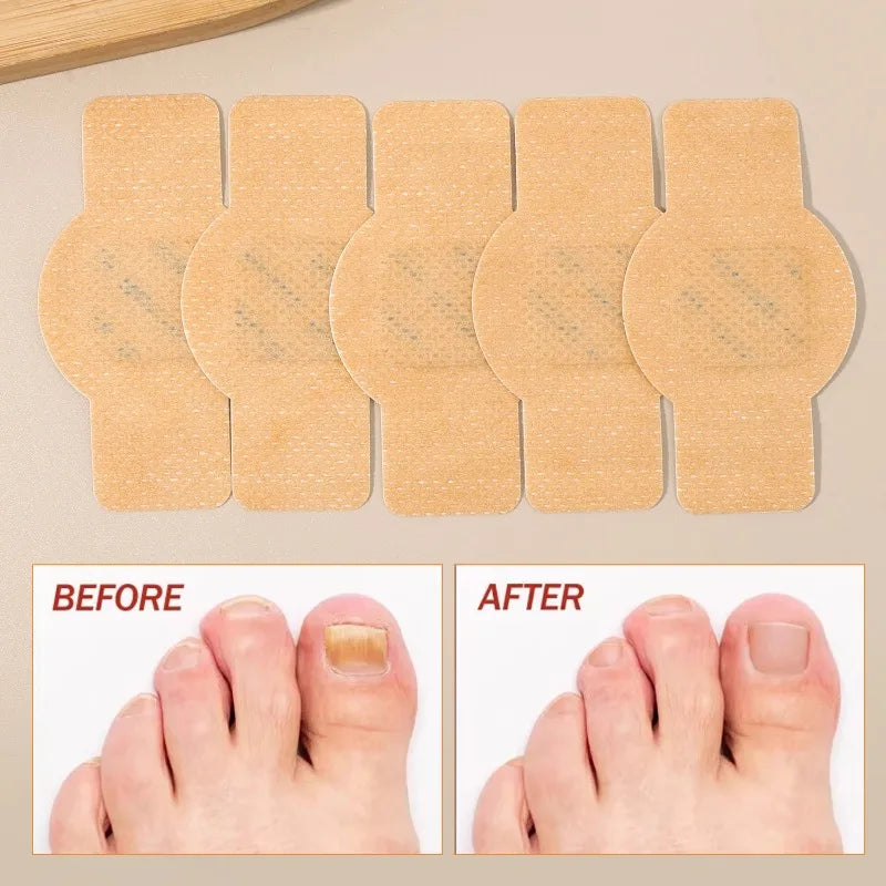 210pcs Waterproof Nail Fungus Correction Patch Finger Guard Bandage Nail Fungus Hollow Nail Cover Disguise Patch Toenail Care