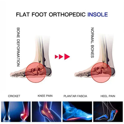 AB Professional Arch Support Insole for Flat Feet Shoe Cushion Orthopedic Pad for Bicycle Football Running Sports