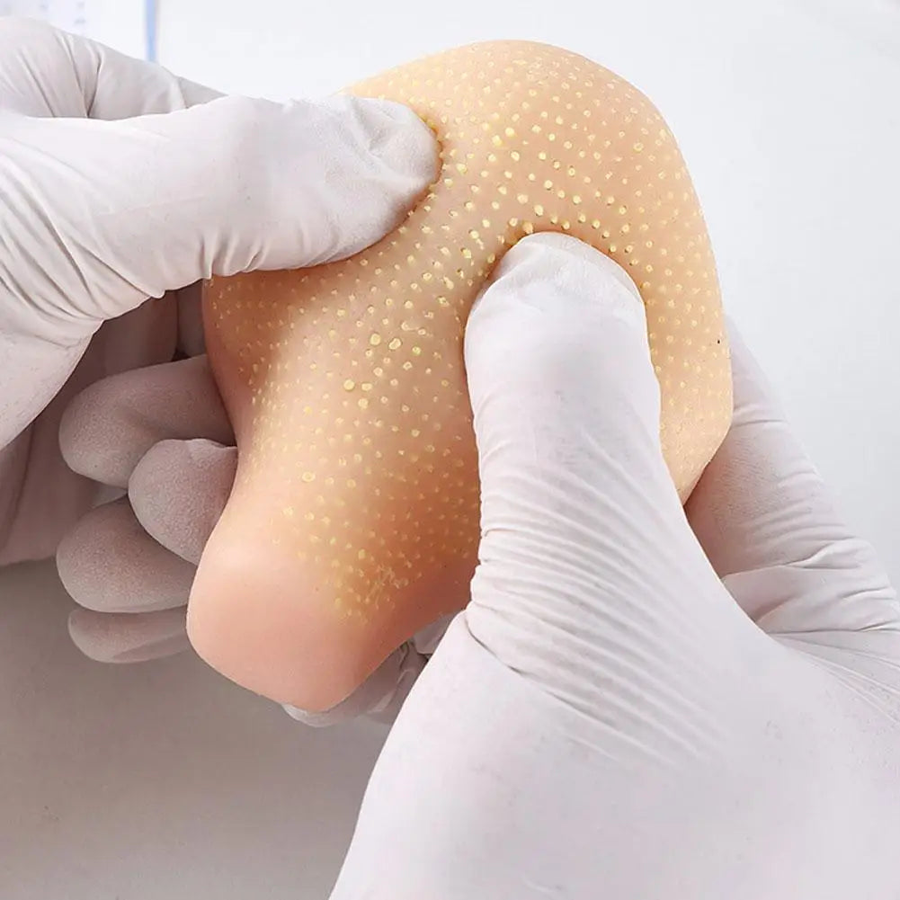 Realistic Pimple Popper Fidget Toy Reusable Sensory Stress Reliever For Anxiety Simulation Blackhead Squeezing Model