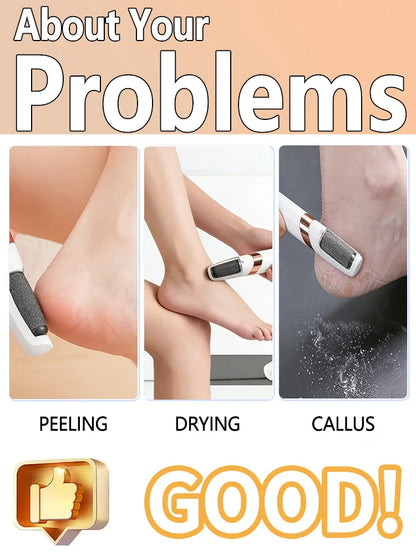 Electric Foot Heel Callus Remover Feet Dead Skin Removal Skin Care Tool Portable Pedicure Rasp  Electric foot grinder