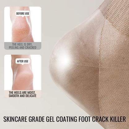 MiiOW Gel Cushion Sock Cracked Dry Skin Heel Protection Elderly Sock Anti Odor Five Finger Sock Women Pure Cotton Spilt Toe Sock