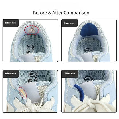 6pcs Sports Shoe Patches Shoes Damaged Side Edges Inner lining Sticker Shoe Heel Wear Repair Patch Foot Care products