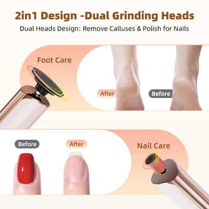 Callus Remover, Electric Foot Exfoliator, Foot Exfoliating Pad, Foot Care Device, Dead Skin Remover