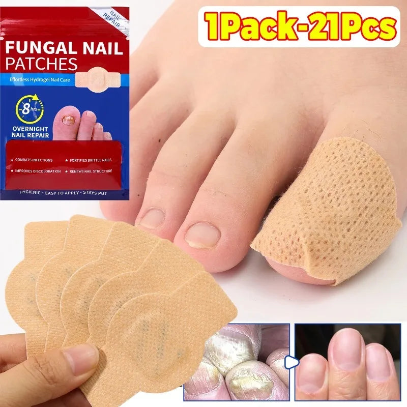 210pcs Waterproof Nail Fungus Correction Patch Finger Guard Bandage Nail Fungus Hollow Nail Cover Disguise Patch Toenail Care