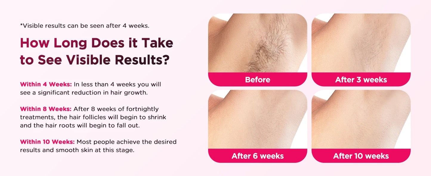 990000 Flash Laser Epilator IPL Hair Removal For Men and Women Body Bikini Facial  Permanant Painless IPL Hair Remover Machine