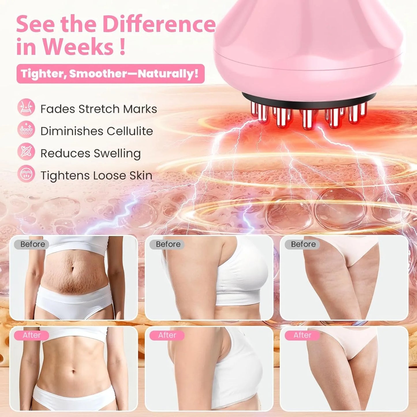 New Electric Meridian Brush 9 Levels Vibration Body Massager Shaping Reduce Stretch Marks Cellulit Relax Muscle Massage Tool