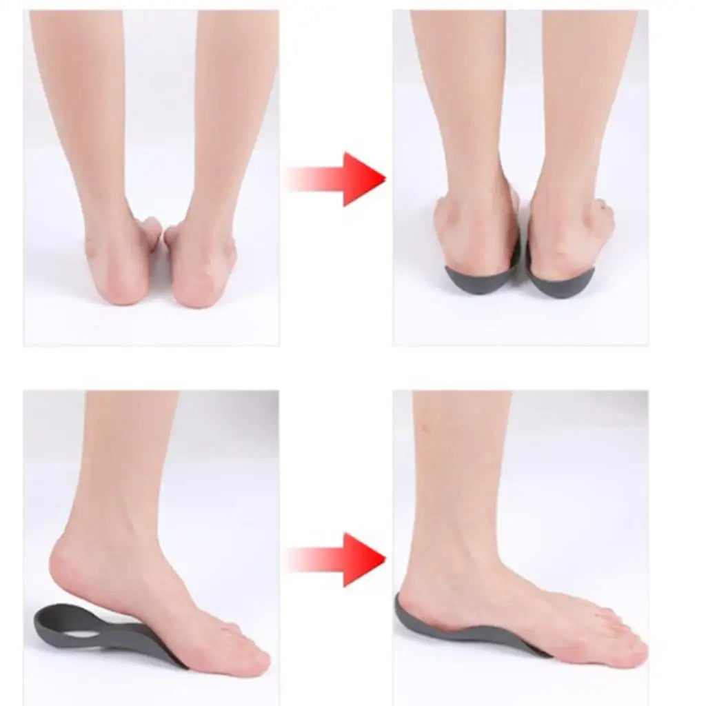 Arch Support Insole for Shoes Flat Foot Orthopedic Cushion Insert for Long Lasting Foot Comfort