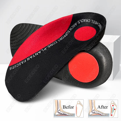 Flat Feet Insole Severe Orthotic Arch Support Insert Orthopedic Shoes Sole Pads Heel Pain Plantar Fasciitis Men Woman Unisex