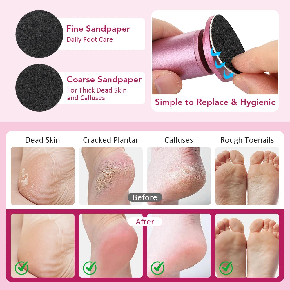 Electric Foot Callus Remover Foot Care File Exfoliator For Cracked Heels Dead Skin Removal Professional Pedicure Tools Sandpaper