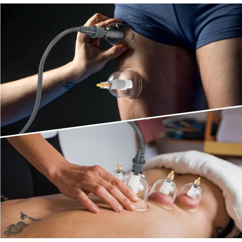 24Pcs Cupping Relax Set Multiple Sizes of Vacuum Cups with Hand Pump and Detailed Cupping Manual Massage Cupping Set for Massage