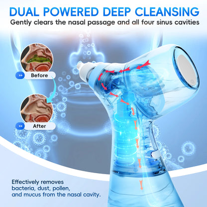Electric Nasal Rinse Irrigation,30 Salt Packets, for Relieving Sinus Discomfort, Self-Cleaning and Automatic Waste Collection