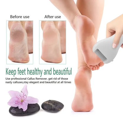 Rechargeable Electric Foot Grinder - USB Powered Callus Remover with Adjustable Speeds, for Men & Women's Pedicure and Self-Care