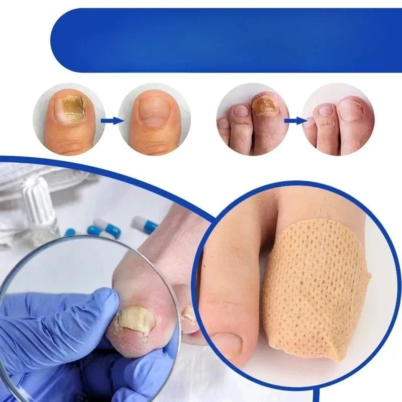 210pcs Waterproof Nail Fungus Correction Patch Finger Guard Bandage Nail Fungus Hollow Nail Cover Disguise Patch Toenail Care